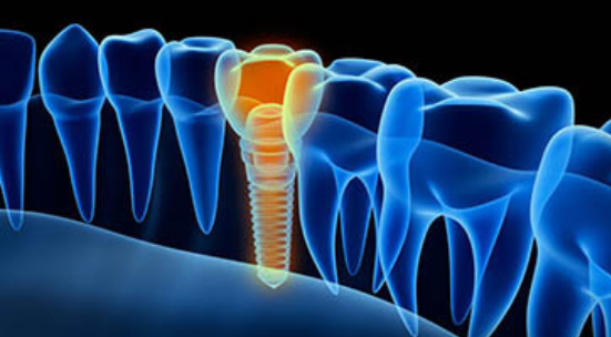 General Dentistry Image