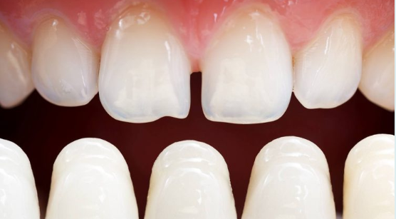 General Dentistry Image