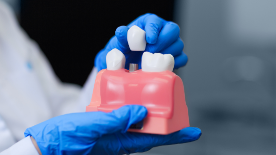 General Dentistry Image